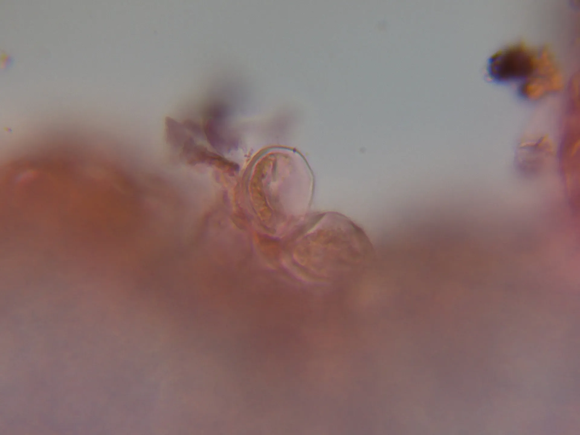 Microscopía de Taphrina deformans - 6 - Ascos inmaduros-001